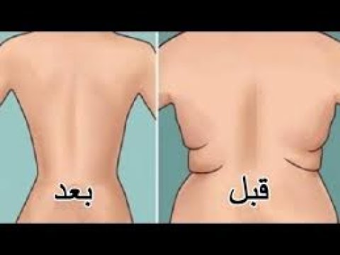 دهون الظهر وكيفية التخلص منها