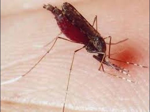  مرض الملاريا وأسبابه