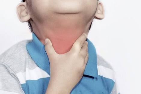 أعراض مرض الدفتيريا عند الأطفال