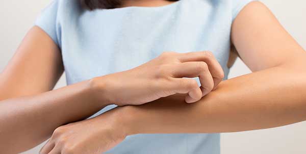 علاج مرض الجرب بالأعشاب