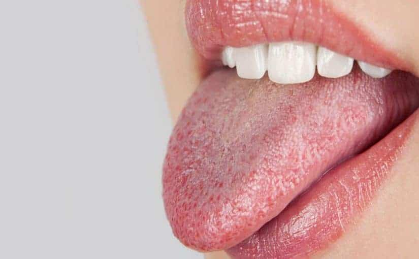 أسباب العطش وجفاف الفم